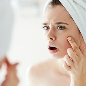 7 Common Culprits that Cause Acne