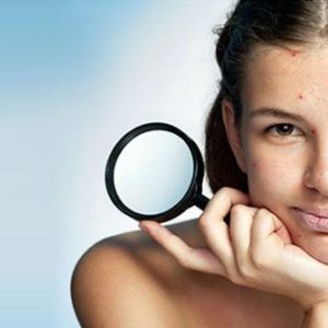 6 Best Ways To Manage Acne