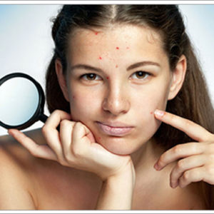 Curing skin problems with homeopathy