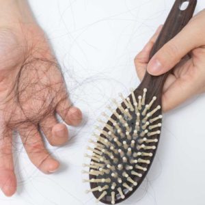 Symptoms of male pattern baldness