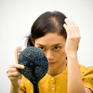 What is Female-pattern baldness?