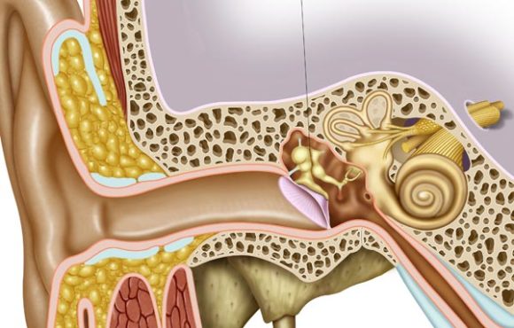 Acute Suppurative Otitis Media (Discharge from ear)