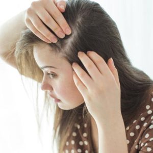 Hair Loss After Hair Colouring