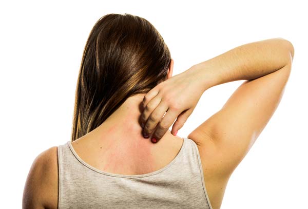 skin allergy