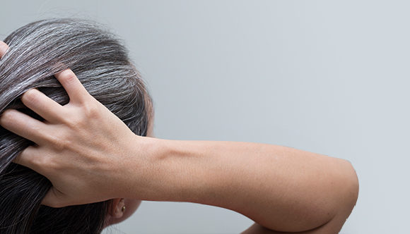 What Causes Greying of Hair